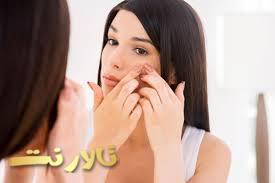 درمان لک های پوستی،درمان اکنه